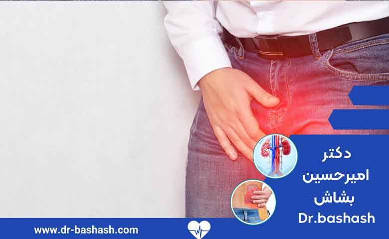 عمل واریکوسل در مشهد