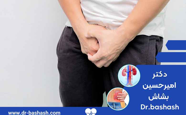 عوارض هیپوسپادیاس