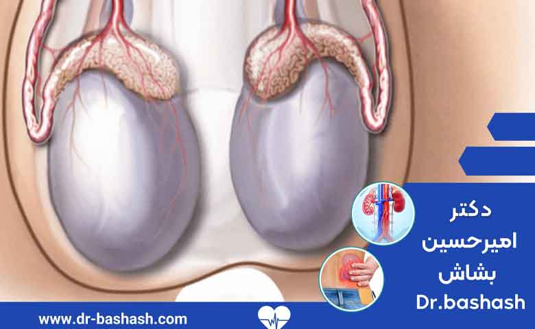 تفاوت وازوازستومی و وازواپیدیدیموستومی