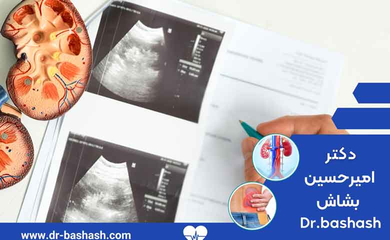 علائم بدخیمی های لگنچه کلیه