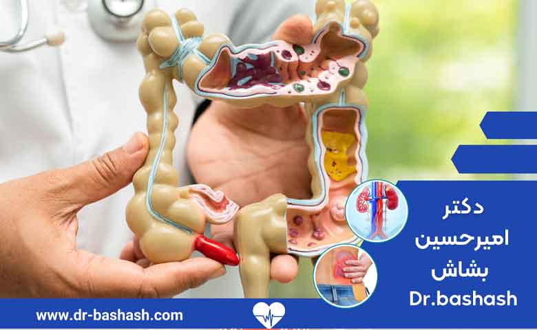 عوارض عمل برداشتن مثانه
