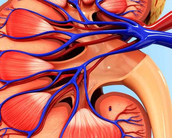 جراحی سنگ حالب