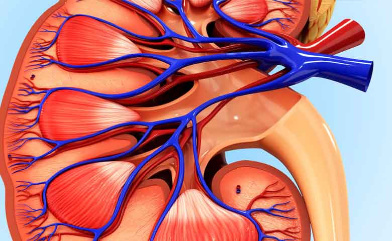 جراحی سنگ حالب