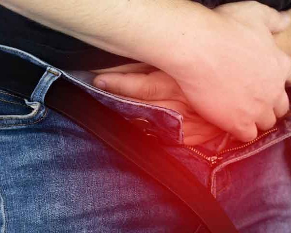 کرایوتراپی زگیل تناسلی