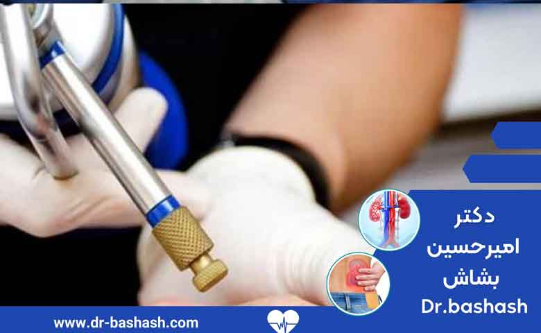 نکته هایی که باید قبل از انجام کرایو تراپی رعایت شوند