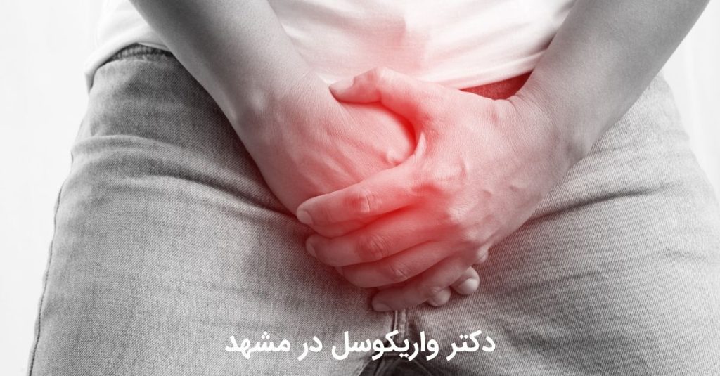 برای دکتر واریکوسل در مشهد