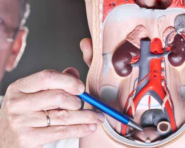 سرطان مثانه