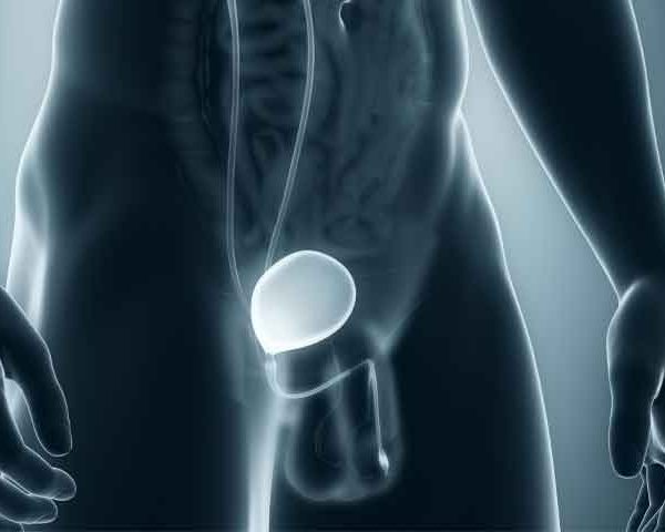 مشکل تنگی مجرای ادرار از نشانه ها تا معالجه