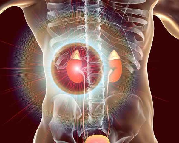 مراقبت های بعد از عمل تنگی حالب