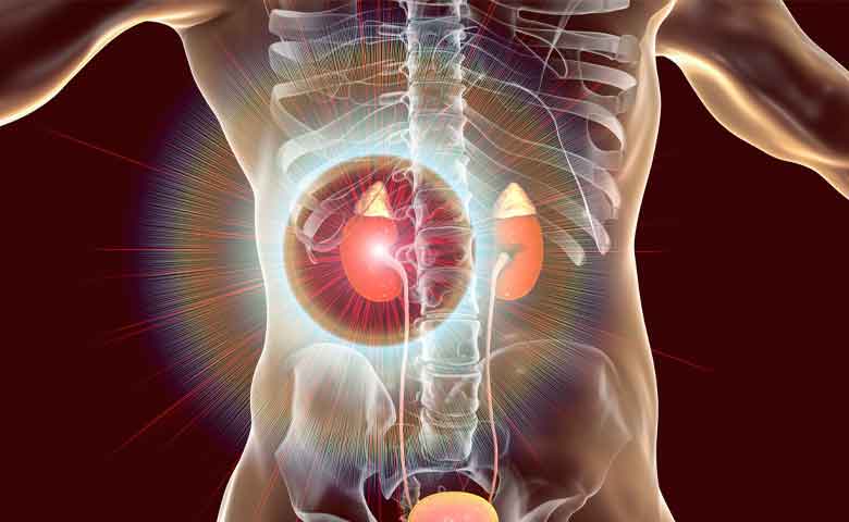 مراقبت های بعد از عمل تنگی حالب