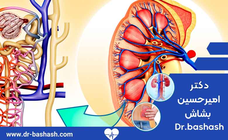 علت تنگی مجرای ادرار در مردان