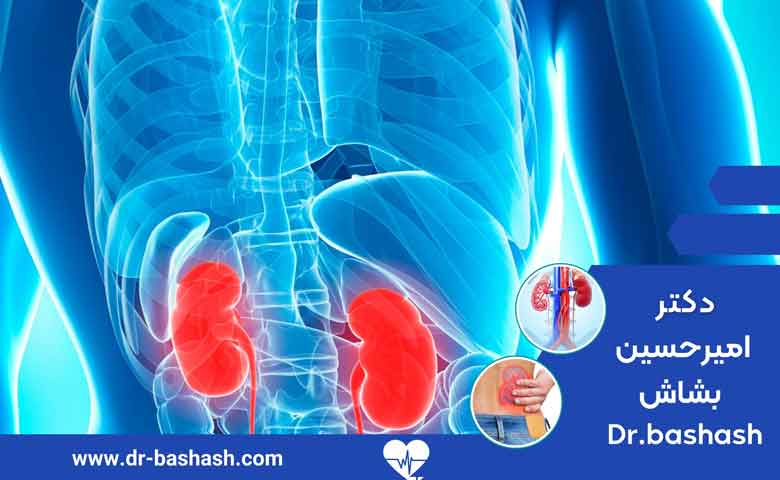 بیماری کلیه پلی کیستیک چه علائمی دارد؟