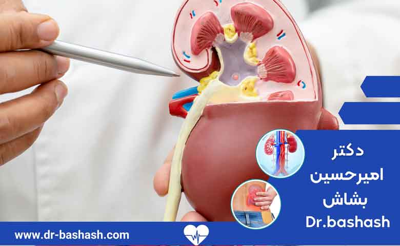 کیست ساده کلیه به چه علتی تشکیل می شود؟