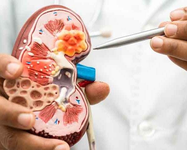 ۱۴ علائم بیماری کلیوی قسمت اول