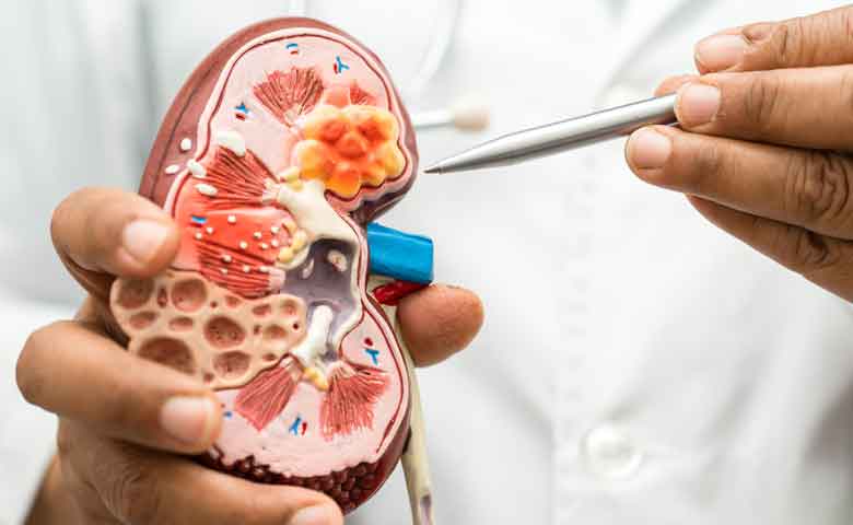 ۱۴ علائم بیماری کلیوی قسمت اول