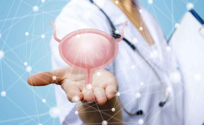 مراحل انجام نوار مثانه و هزینه نوار مثانه