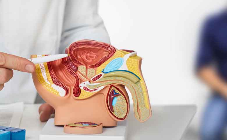 کرایوتراپی مشهد