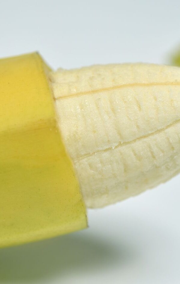 ختنه در مشهد