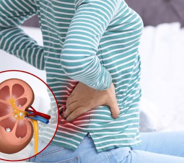 جراحی کلیه در مشهد