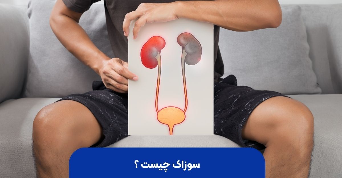 سوزاک چیست ؟