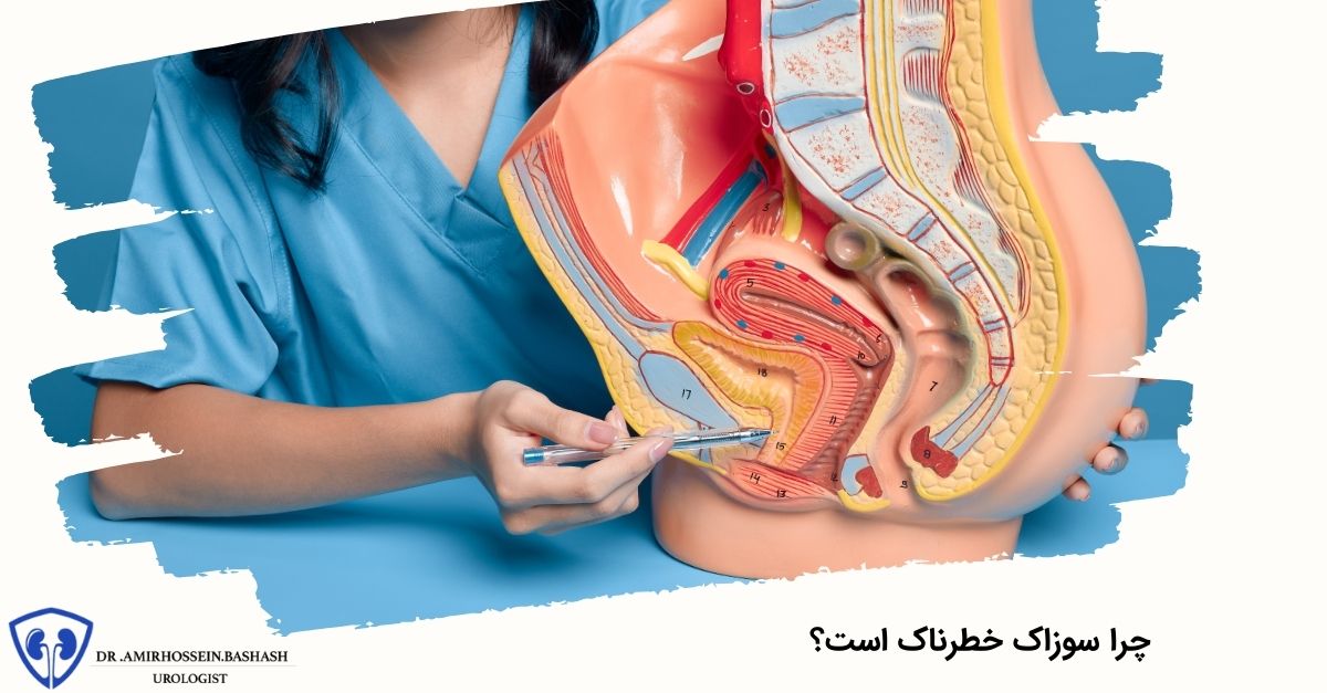 چرا سوزاک خطرناک است؟