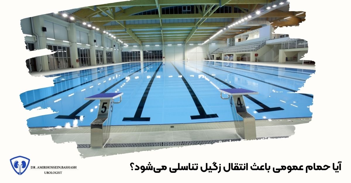 آیا حمام عمومی باعث انتقال زگیل تناسلی می‌شود؟