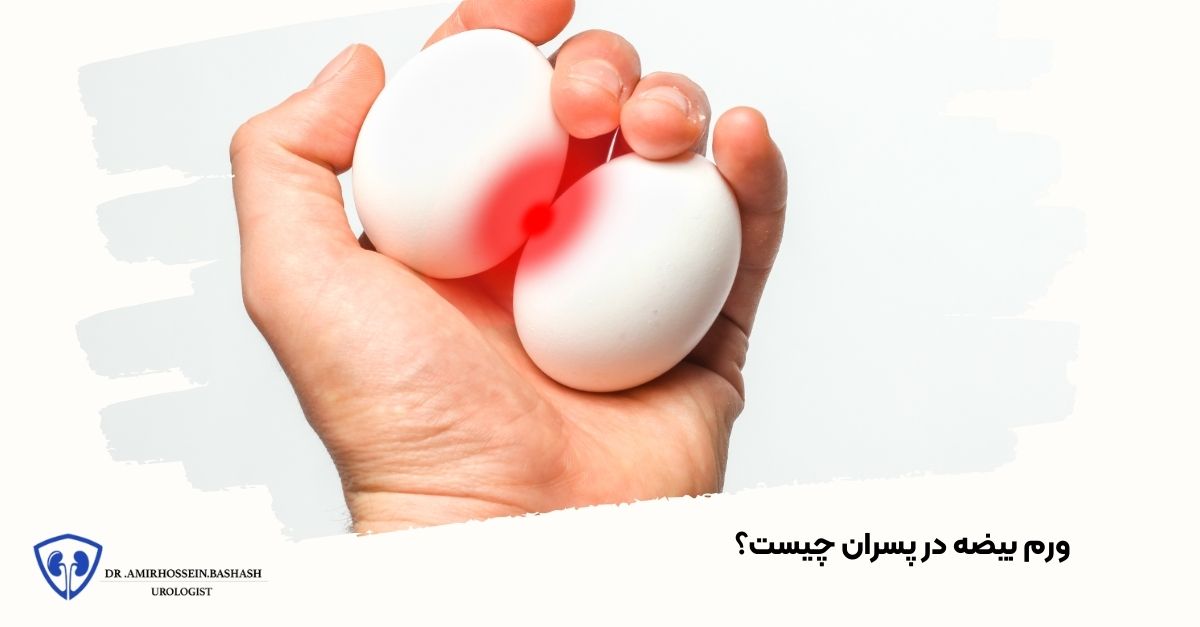 ورم بیضه در پسران چیست؟