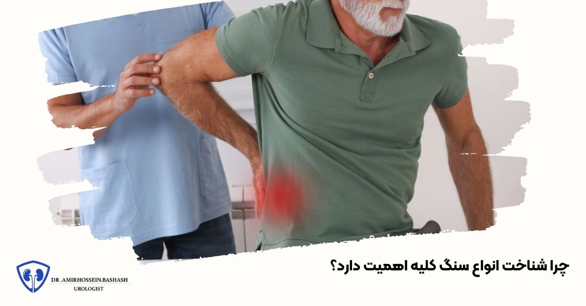 چرا شناخت انواع سنگ کلیه اهمیت دارد؟