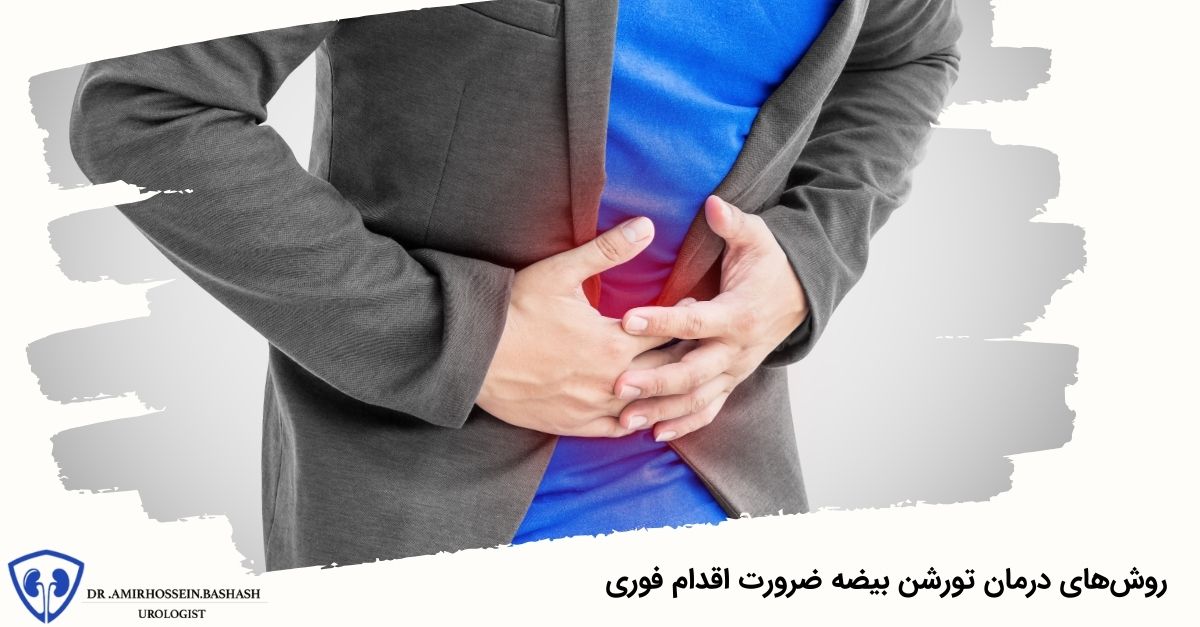 روش‌های درمان تورشن بیضه ضرورت اقدام فوری