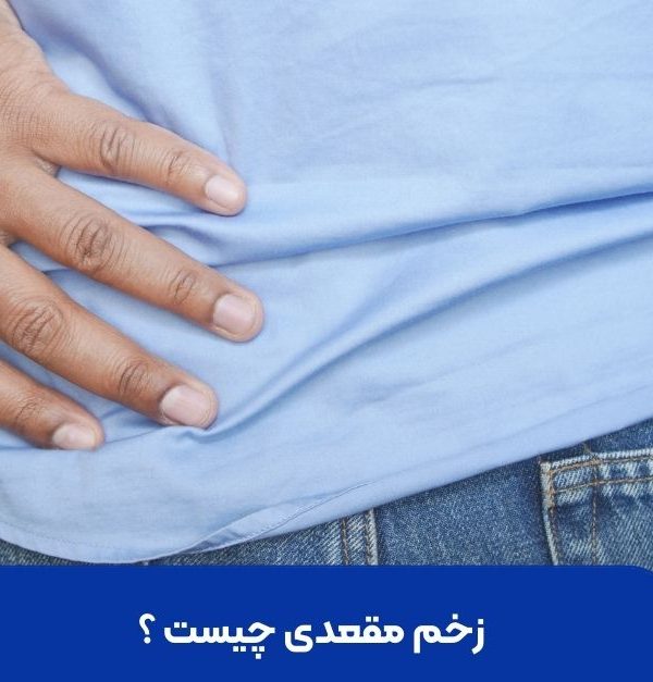 زخم مقعدی چیست ؟