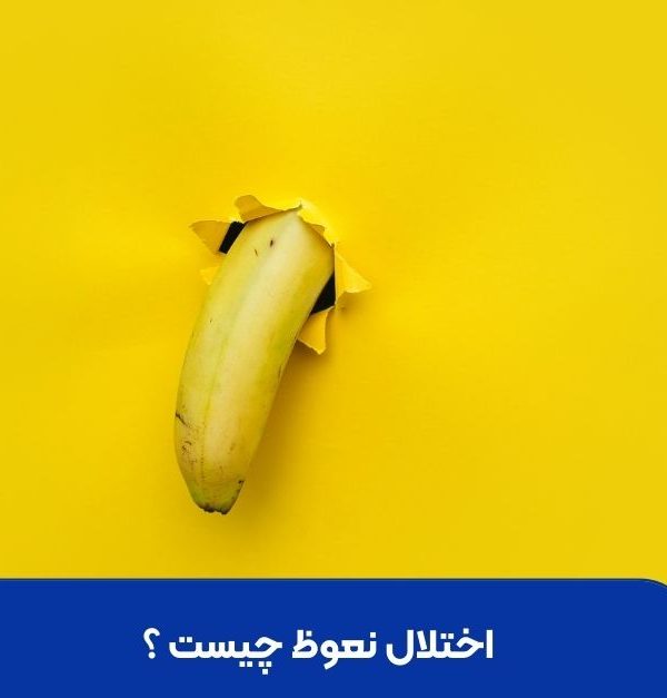 اختلال نعوظ چیست ؟