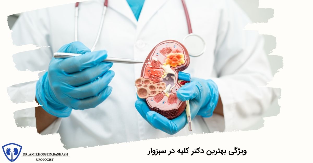ویژگی بهترین دکتر کلیه در سبزوار
