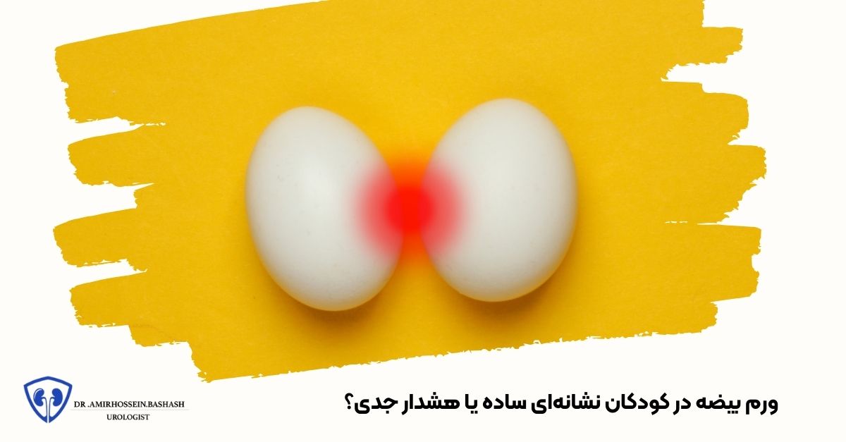 ورم بیضه در کودکان نشانه‌ای ساده یا هشدار جدی؟