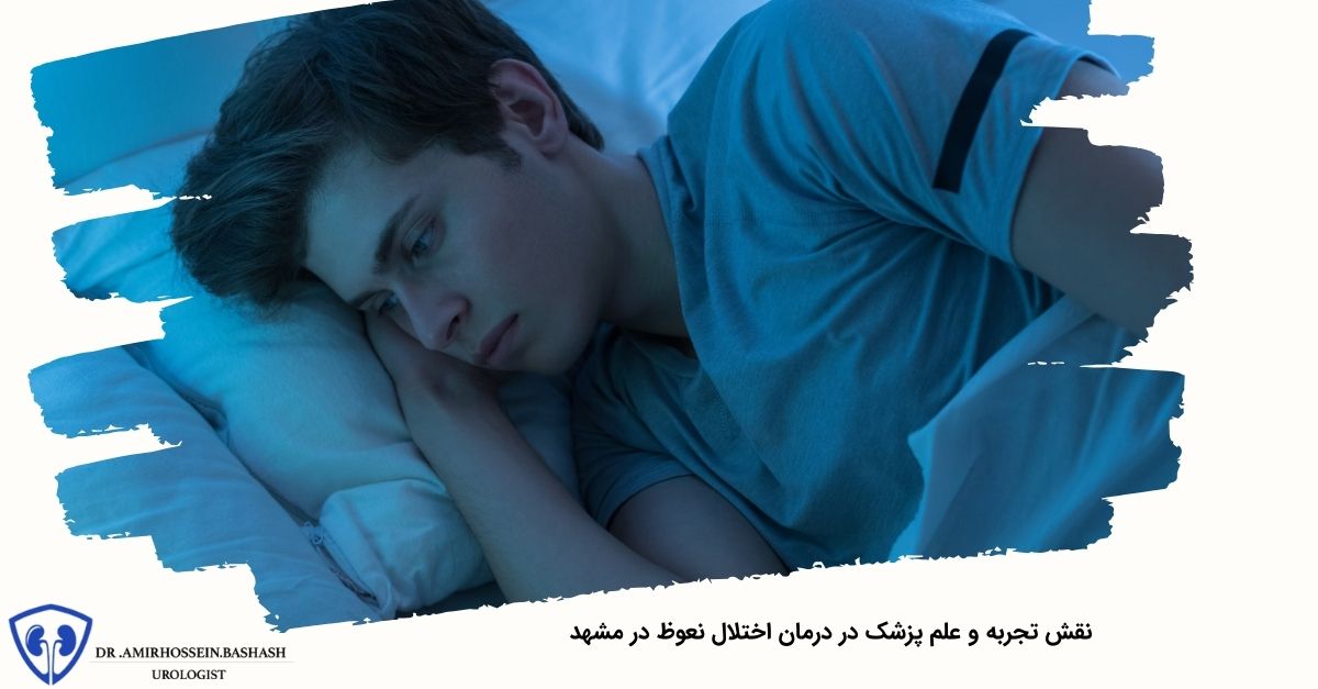 نقش تجربه و علم پزشک در درمان اختلال نعوظ در مشهد