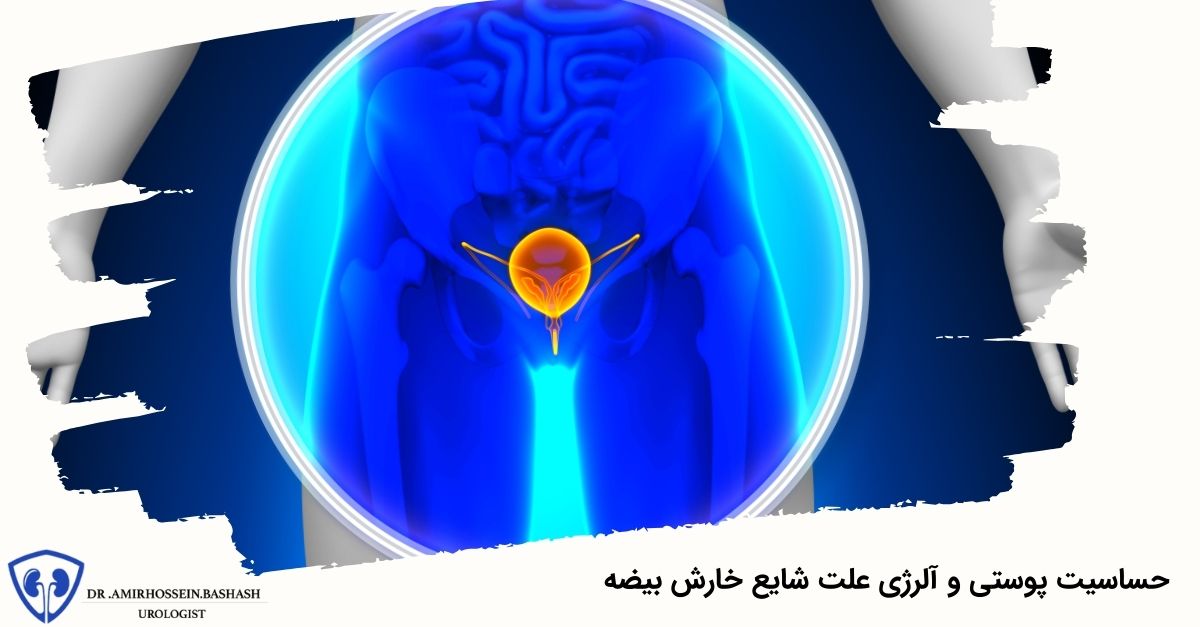 حساسیت پوستی و آلرژی علت شایع خارش بیضه