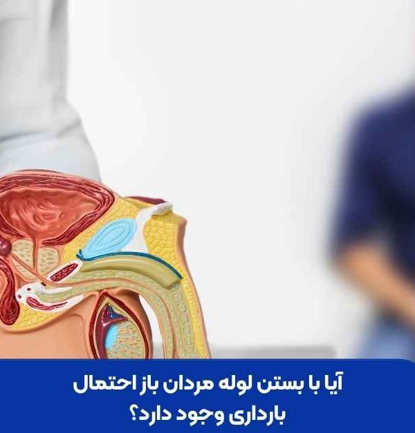 آیا با بستن لوله مردان باز احتمال بارداری وجود دارد؟