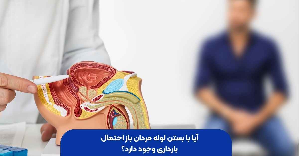 آیا با بستن لوله مردان باز احتمال بارداری وجود دارد؟