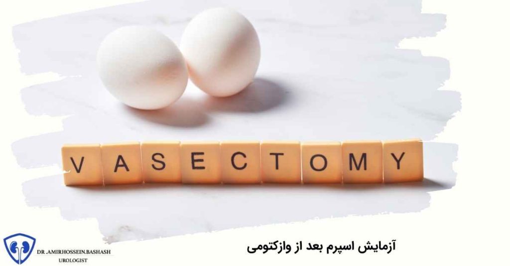 آزمایش اسپرم بعد از وازکتومی