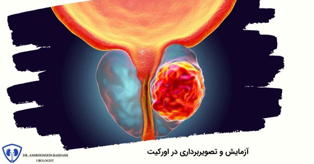 آزمایش و تصویربرداری در اورکیت